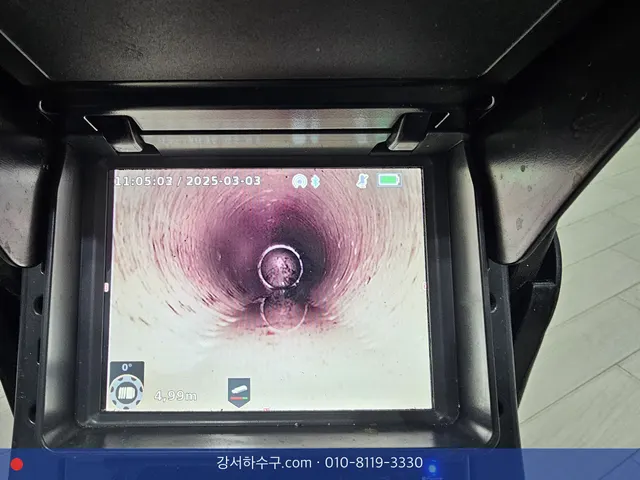 작업 뒤 내시경 화면, 안쪽 벽이 매끈해진 관