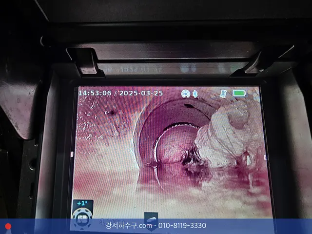 내시경 화면 속 관 안에 걸린 이물